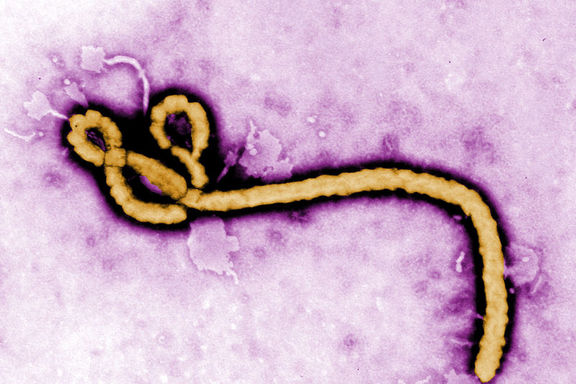 Gine'de yeni Ebola vakası