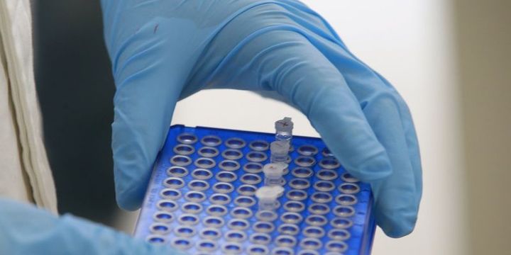 Japon biyoteknoloji şirketi hisseleri "buluş" sonrası sert yükseldi