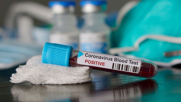 Koronavirüsün bilançosu ağırlaşıyor: Dünyada virüs bulaşan kişi sayısı 133 bini aştı