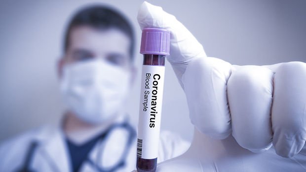 Dünya ekonomileri gelecek hafta koronavirüsün hasarlarını ölçecek
