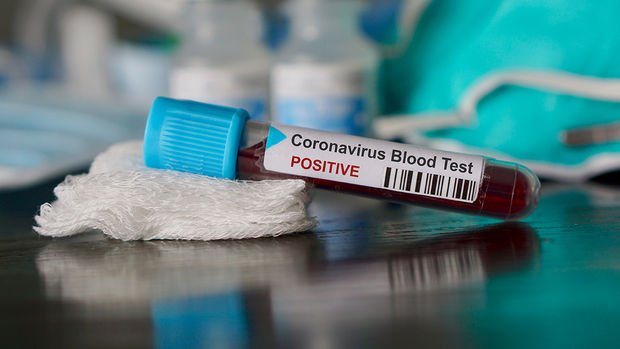 Koronavirüs pandemisi: Dünya genelinde can kaybı 18 bin 900'ü geçti