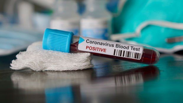 Koronavirüs pandemisi: Dünya genelinde 82 bin 136 kişi öldü, vaka sayısı 1,5 milyona yaklaştı
