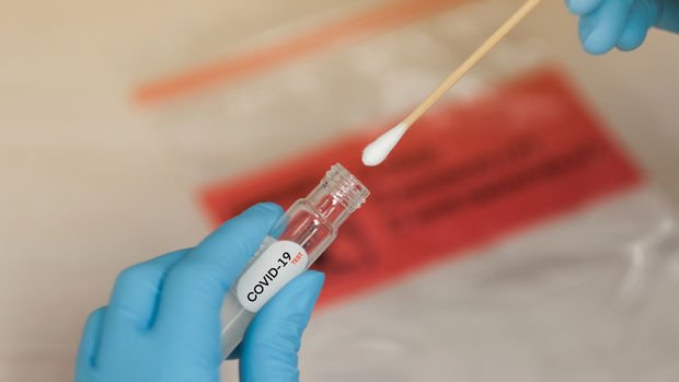Koronavirüs pandemisinde hayatını kaybedenlerin sayısı 1 milyonu aştı