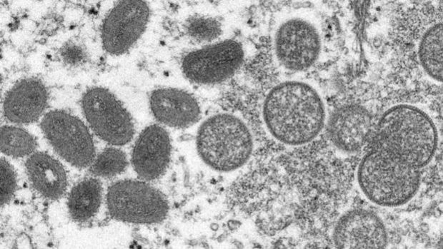ABD’de maymun çiçeği virüsü nedeniyle acil durum ilan edildi
