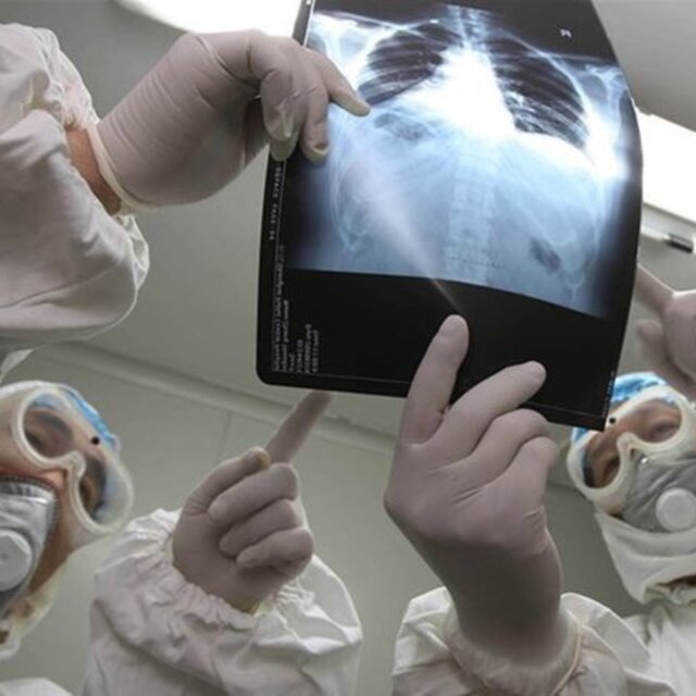 Çin'de "gizemli hastalığa" yol açan virüsün insandan insana bulaştığı tespit edildi