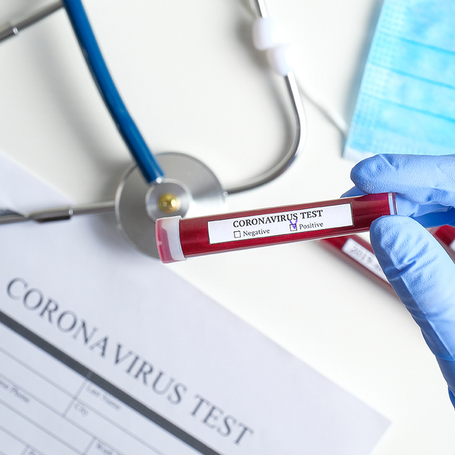 Çin’de Kovid-19 salgınında can kaybı 3 bin 172'ye yükseldi