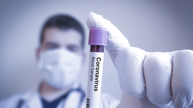 Covid -19 Sürecinde Ekonomi Politikaları