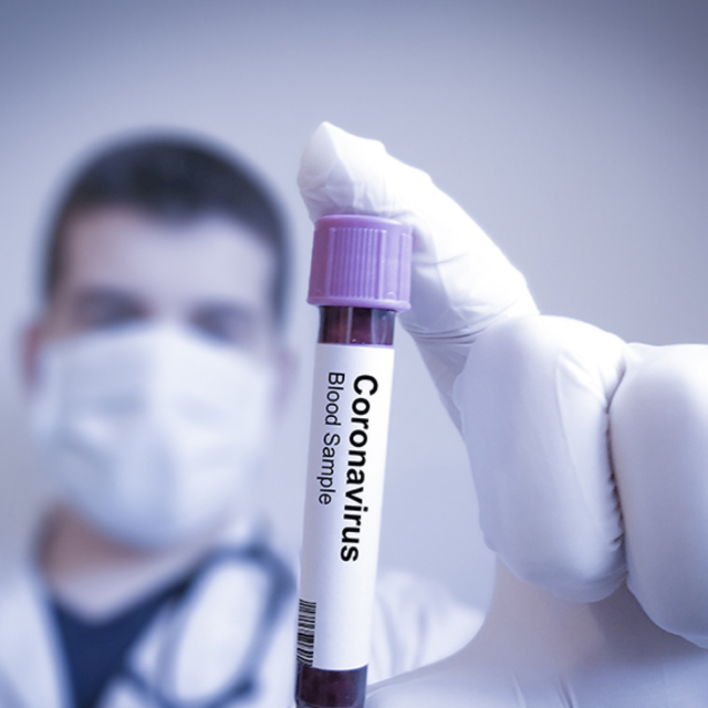 Dünyada Kovid-19 vakalarında artış hızlandı