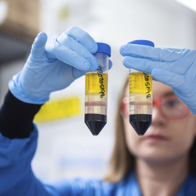 AstraZeneca daha fazla deney planlıyor