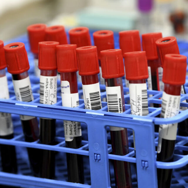 Bakan Koca: Hedef yazdan önce 100 milyon doz