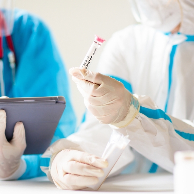 Günlük vaka sayısı 90 bini aştı