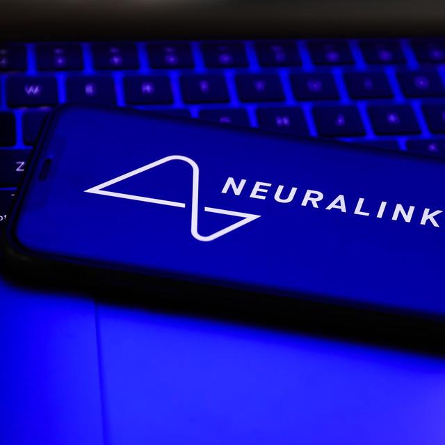 Musk'ın çılgın projesi Neuralink'te insan deneyleri geliyor - 3 yıl önce